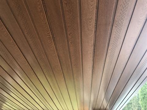 Soffit-pakalimai-virs-terasos-LT